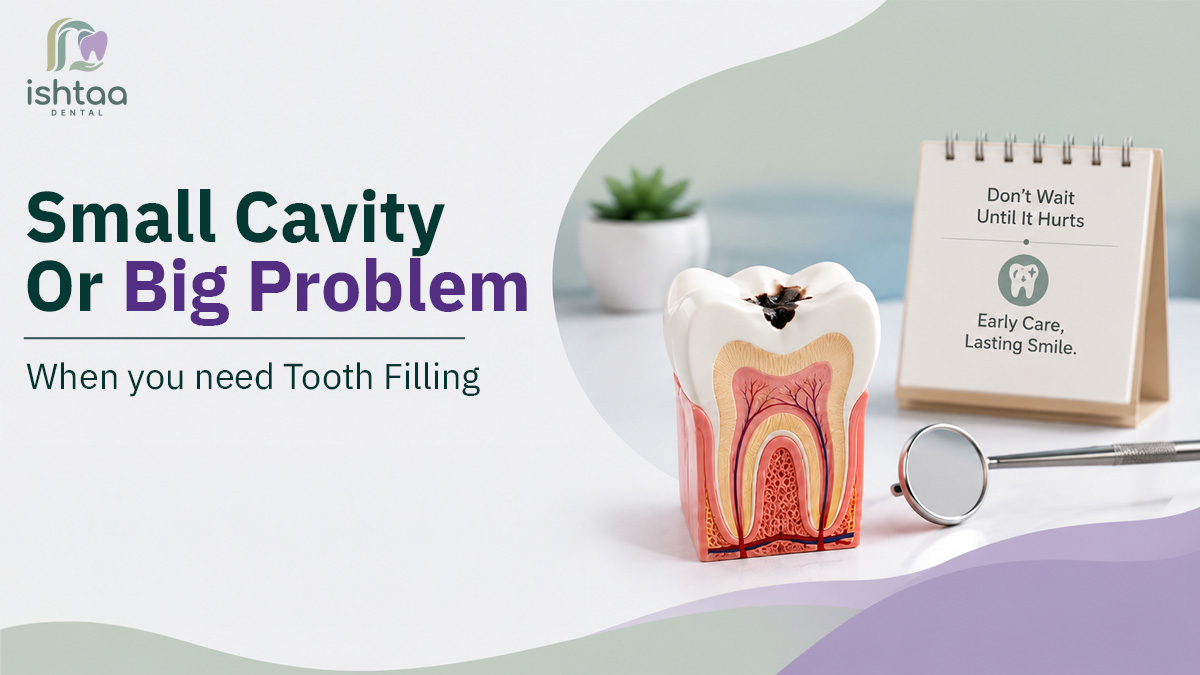 tooth-filling