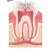 Opening Created