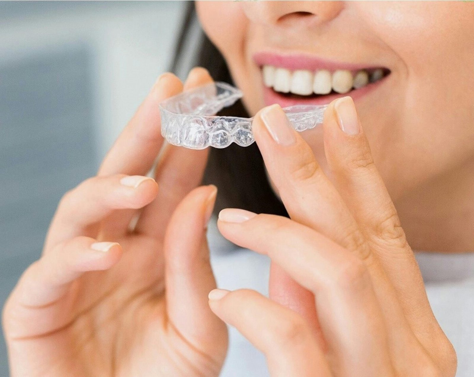 Clear Aligners in Shilaj and South Bopal, Ahmedabad