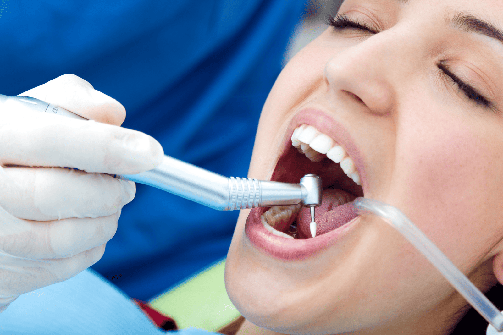 Root Canal Treatment in Shilaj & South Bopal, Ahmedabad